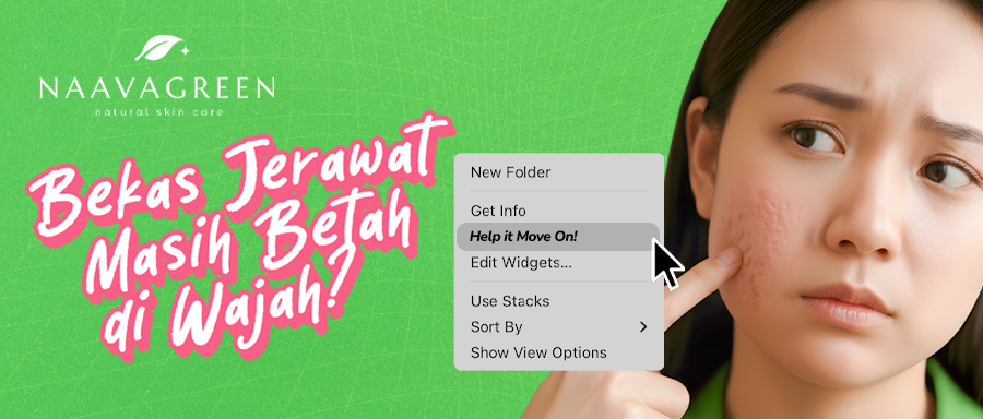 Bekas Jerawat Masih Betah di Wajah? Saatnya Kulit Ikut Move On