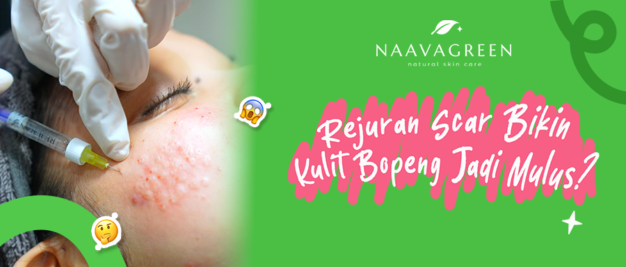 Rela Ditusuk demi Kulit Mulus Lagi di Naavagreen