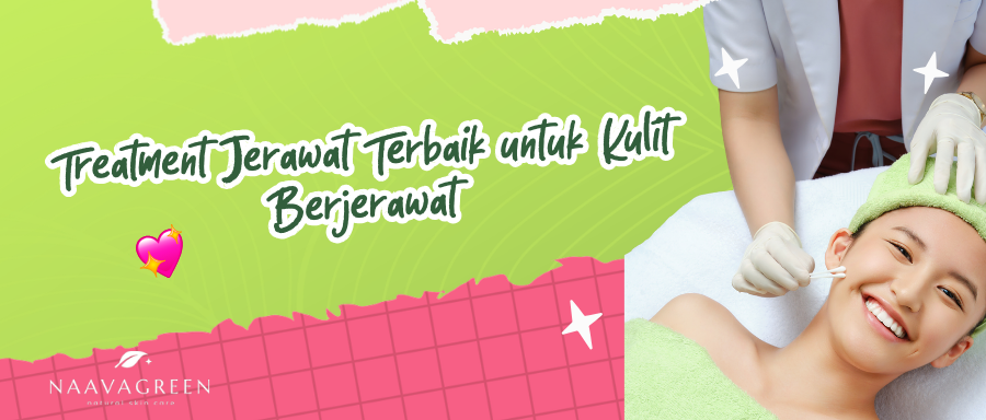 Treatment Jerawat Terbaik untuk Kulit Berjerawat