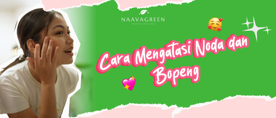 Treatment Bekas Jerawat Terdekat: Cara Mengatasi Noda dan Bopeng