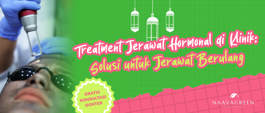Treatment Jerawat Hormonal di Klinik: Solusi untuk Jerawat Berulang