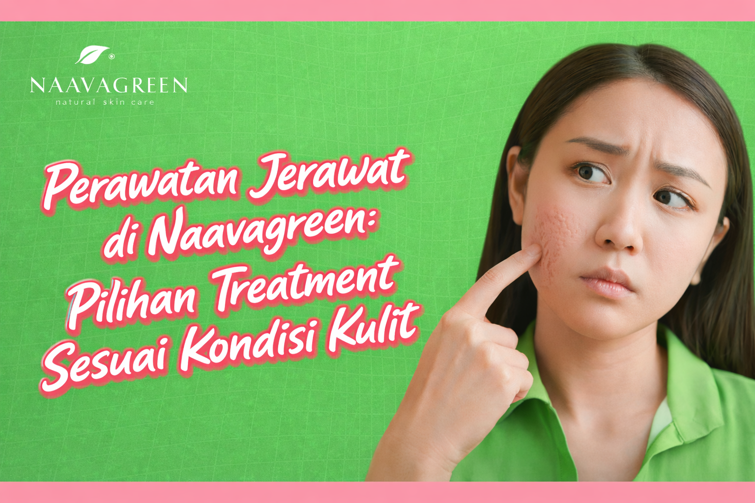 Perawatan Jerawat di Naavagreen: Pilihan Treatment Sesuai Kondisi Kulit