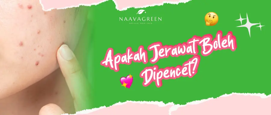 Apakah Jerawat Boleh Dipencet? Ini Risiko yang Perlu Diketahui