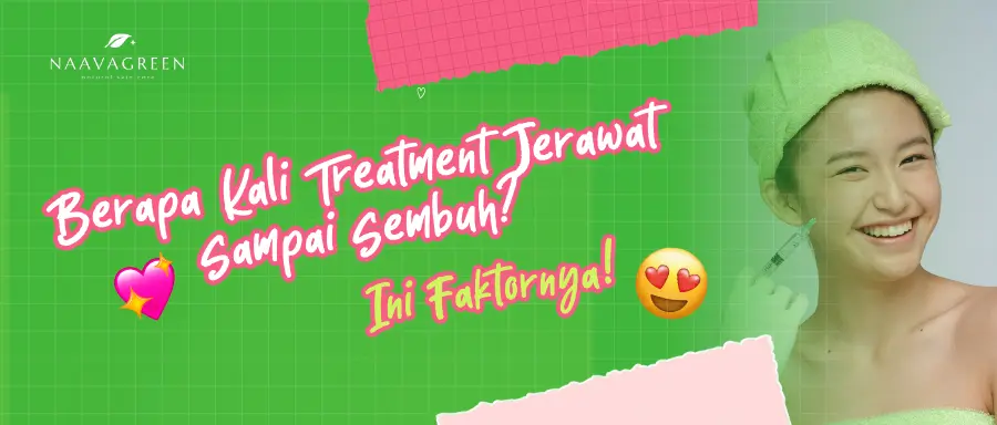 Berapa Kali Treatment Jerawat Sampai Sembuh? Ini Faktornya
