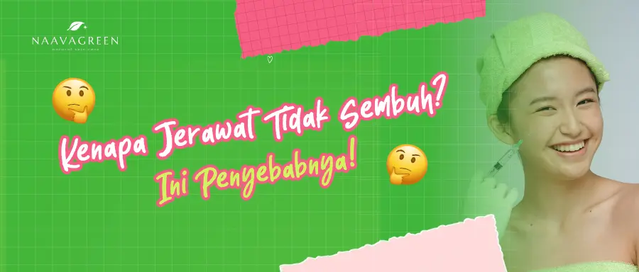 Kenapa Jerawat Tidak Sembuh-Sembuh? Ini Penyebabnya