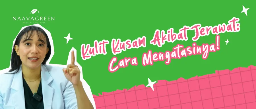 Kulit Kusam Akibat Jerawat: Cara Mengatasinya