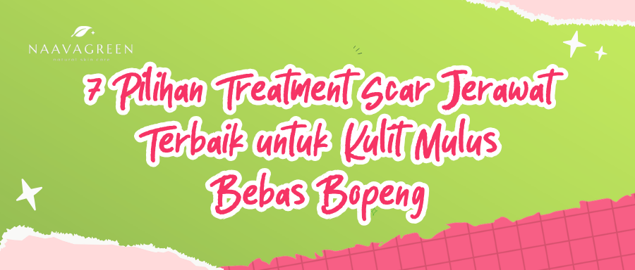 7 Pilihan Treatment Scar Jerawat Terbaik untuk Kulit Mulus Bebas Bopeng