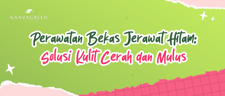 Perawatan Bekas Jerawat Hitam: Solusi Kulit Cerah dan Mulus