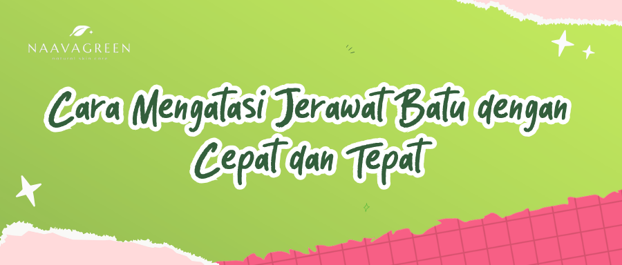 Cara Mengatasi Jerawat Batu dengan Cepat dan Tepat