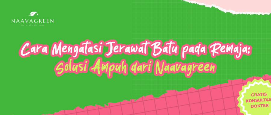 Cara Mengatasi Jerawat Batu pada Remaja: Solusi Ampuh dari Naavagreen