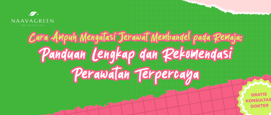 Cara Ampuh Mengatasi Jerawat Membandel pada Remaja: Panduan Lengkap dan Rekomendasi Perawatan Terpercaya