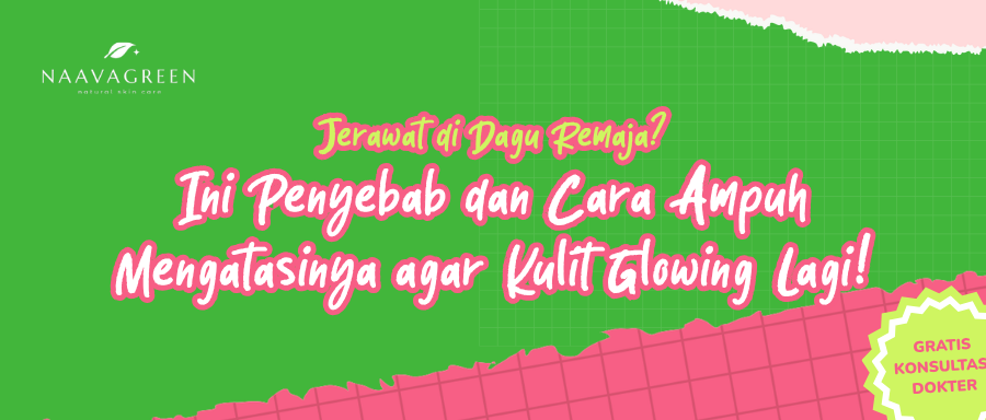 Jerawat di Dagu Remaja? Ini Penyebab dan Cara Ampuh Mengatasinya agar Kulit Glowing Lagi!