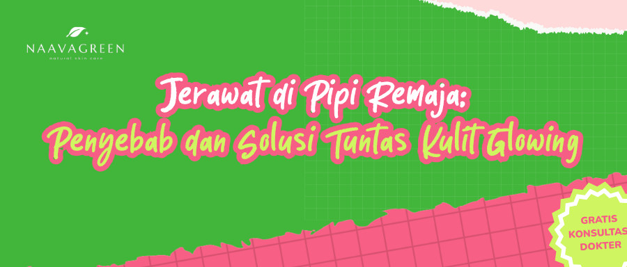 Jerawat di Pipi Remaja: Penyebab dan Solusi Tuntas Kulit Glowing