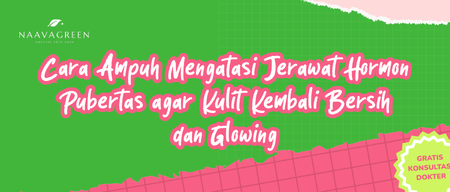 Cara Ampuh Mengatasi Jerawat Hormon Pubertas agar Kulit Kembali Bersih dan Glowing