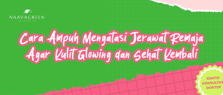 Cara Ampuh Mengatasi Jerawat Remaja Agar Kulit Glowing dan Sehat Kembali