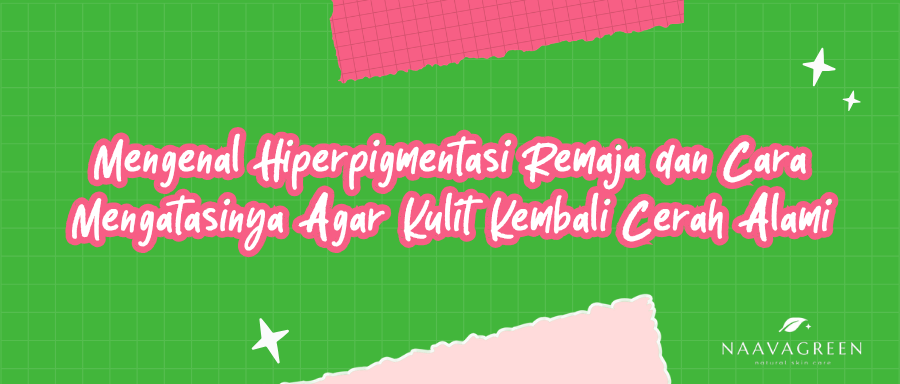 Mengenal Hiperpigmentasi Remaja dan Cara Mengatasinya Agar Kulit Kembali Cerah Alami