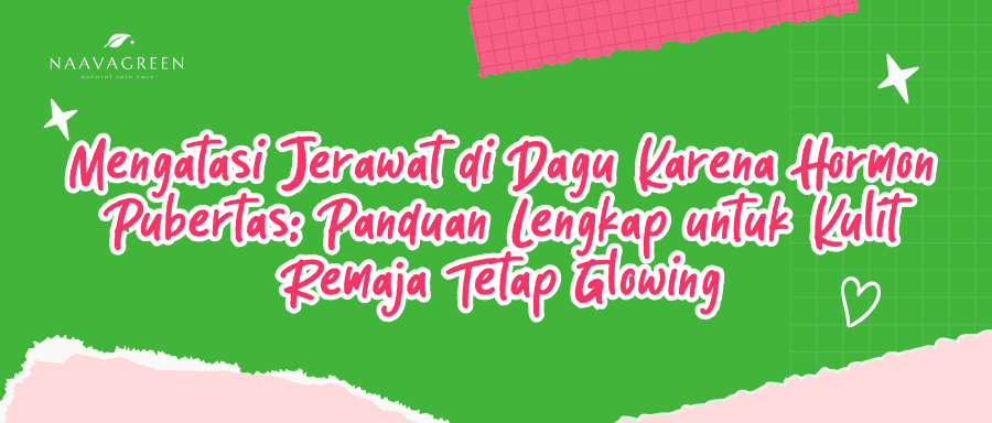Mengatasi Jerawat di Dagu Karena Hormon Pubertas: Panduan Lengkap untuk Kulit Remaja Tetap Glowing