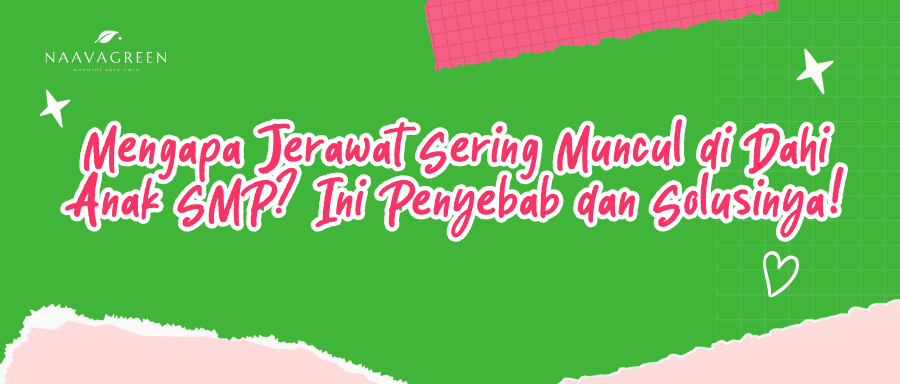 Mengapa Jerawat Sering Muncul di Dahi Anak SMP? Ini Penyebab dan Solusinya!