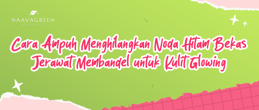 Cara Ampuh Menghilangkan Noda Hitam Bekas Jerawat Membandel untuk Kulit Glowing