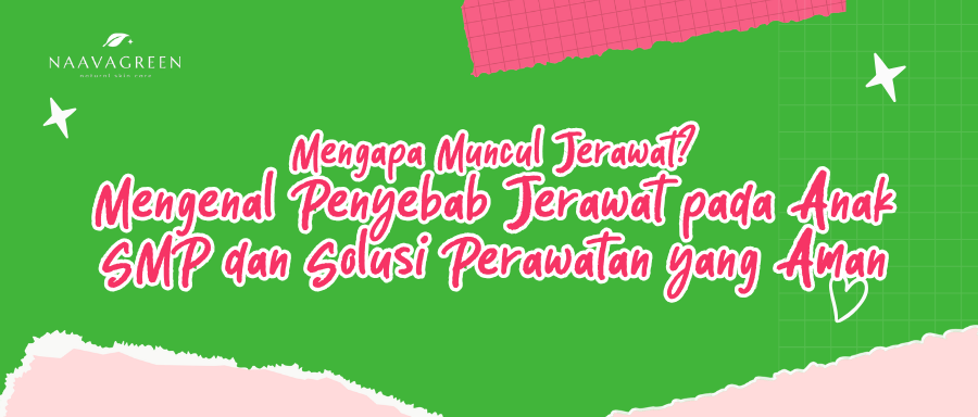 Mengapa Muncul Jerawat? Mengenal Penyebab Jerawat pada Anak SMP dan Solusi Perawatan yang Aman