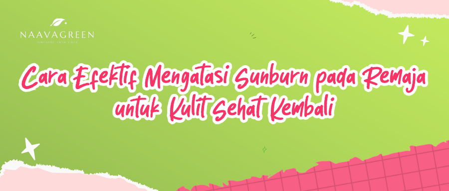 Cara Efektif Mengatasi Sunburn pada Remaja untuk Kulit Sehat Kembali