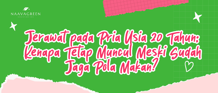 Jerawat pada Pria Usia 20 Tahun: Kenapa Tetap Muncul Meski Sudah Jaga Pola Makan?